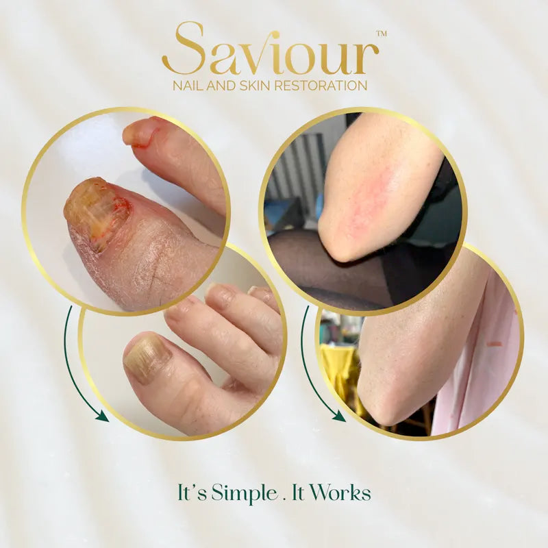 Nail & Skin Restoring Balm