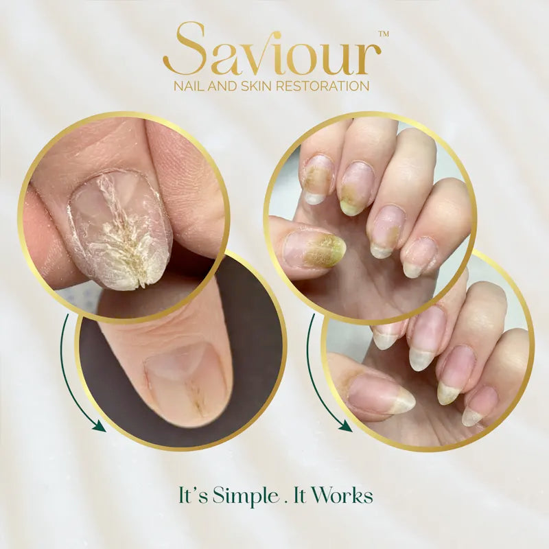 Nail & Skin Restoring Oil